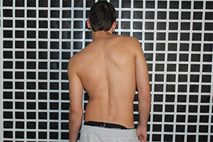 non surgical treatment of scoliosis exercise assymetrical posture